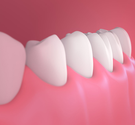 Treatment - Beaumontdental 